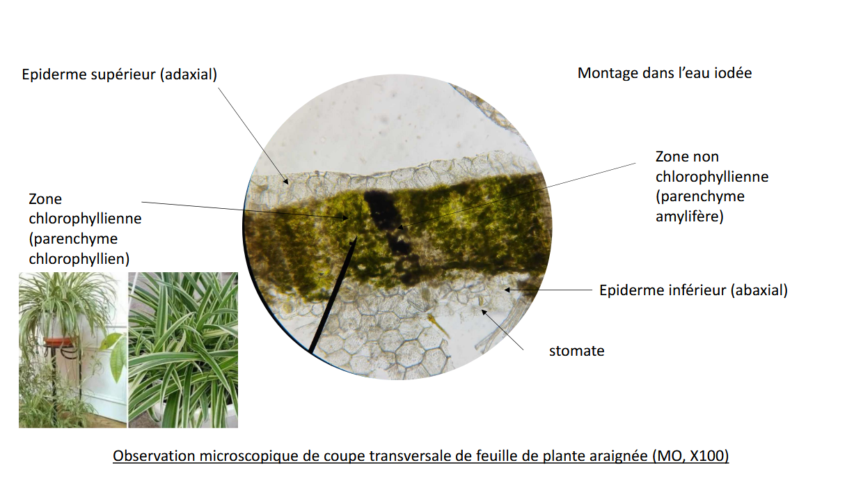 Observation microscopique de feuille de plante araignée avec la zone blanche colorée à l'eau iodée (présence d'amidon) et la zone verte présentant des chloroplastes.